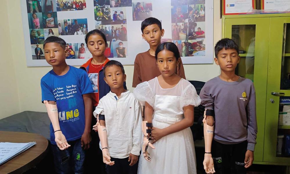 ज्योति विकास बैंकद्वारा बालबालिकालाई कृत्रिम हात प्रदान