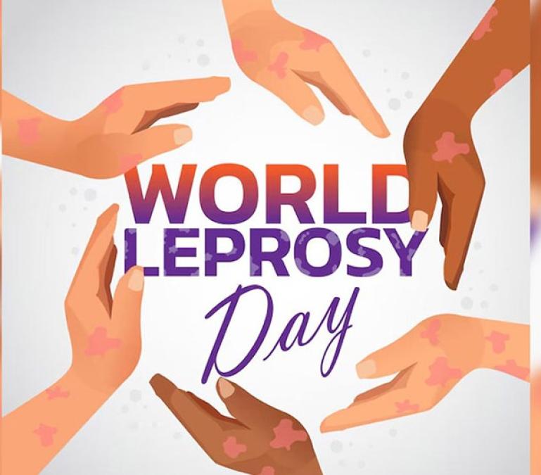 आज ७३ औँ विश्व कुष्ठरोग दिवस मनाइँदै