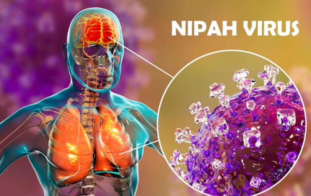 निपाह भाइरसबारे स्वास्थ्य मन्त्रालयको धारणा सार्वजनिक